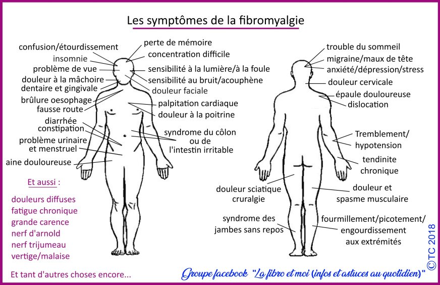 Schéma symptômes fibromyalgie